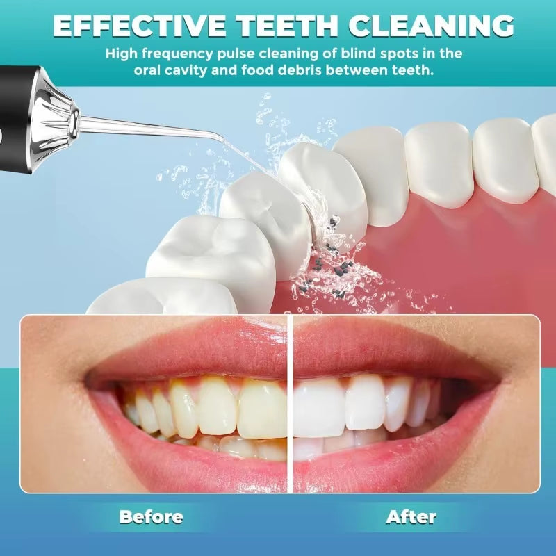 Oral Irrigator Portable USB Rechargeable Dental Water Flosser Water Jet Floss Tooth Pick 4 Jet Tip 220Ml 3 Modes IPX7 Waterproof